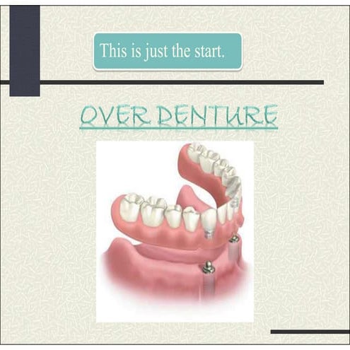 Over denture