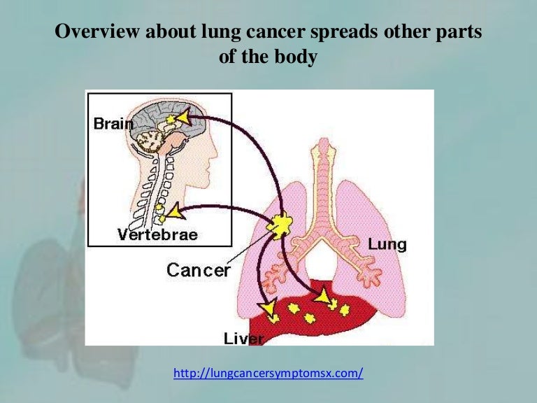 What Parts Of The Body Are Affected By Lung Cancer – LWLWY