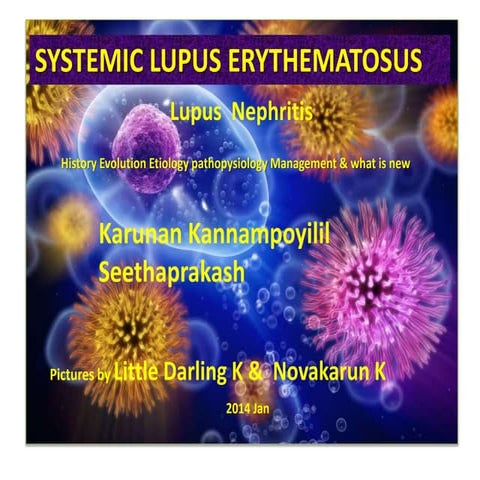 Systemic lupus erythematosis 