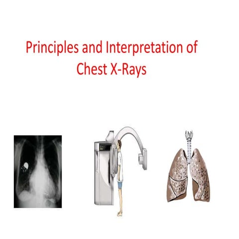 basic_chest_x_ray_.ppt