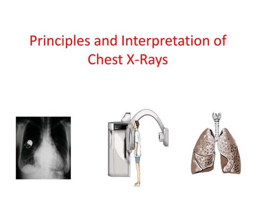 Paeds chest x ray | PPT