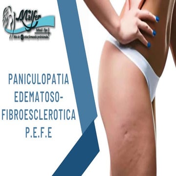 Celulitis_PEFE presentacion medicina.pptx
