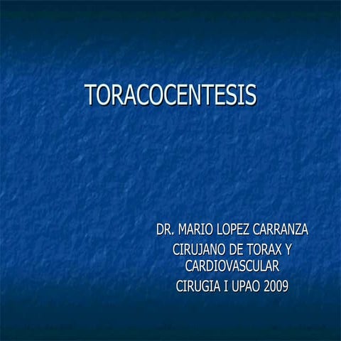 Toracocentesis
