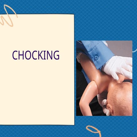P3 CHOKING First Aid management - Daniel | PPTX