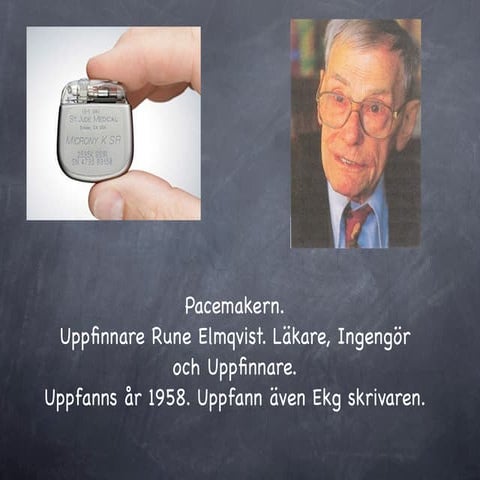 Pacemaker presentation | KEY