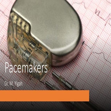 General Overview of Modern Cardiac Pacemakers