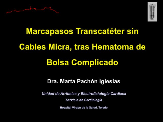 Presentación de caso clínico