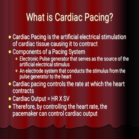 Comprehensive Overview of Cardiac Pacing Systems and Heart Rate ...