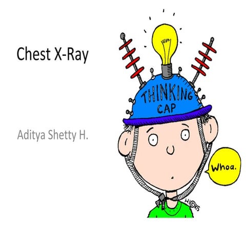 Paeds chest x ray | PPT