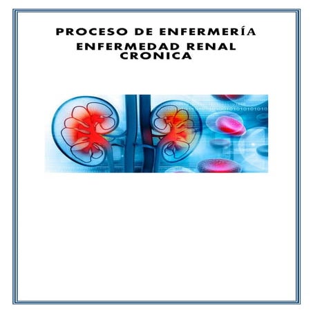 PROCESO DE ENFERMERÍA INSUFICIENCIA RENAL