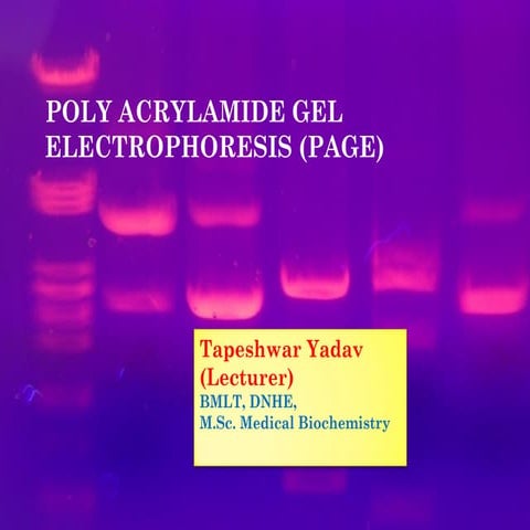 PAGE- Electrophoresis