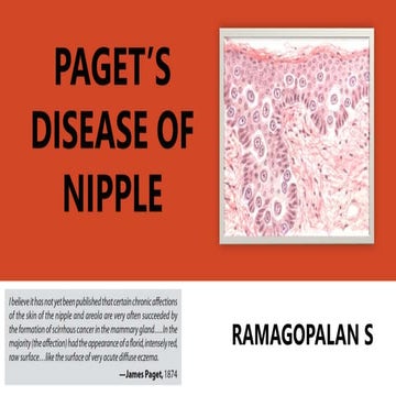 Paget's disease