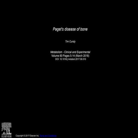 Pagets Disease of Bone presentation.pptx