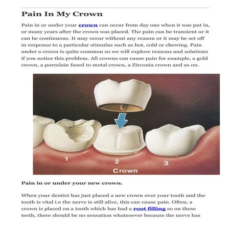 Pain In My Crown - Dr Muzzafar Zaman