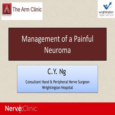 Management of a Painful Neuroma