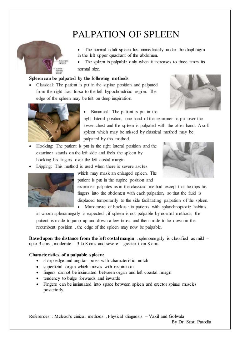 Palpation Of Spleen Final