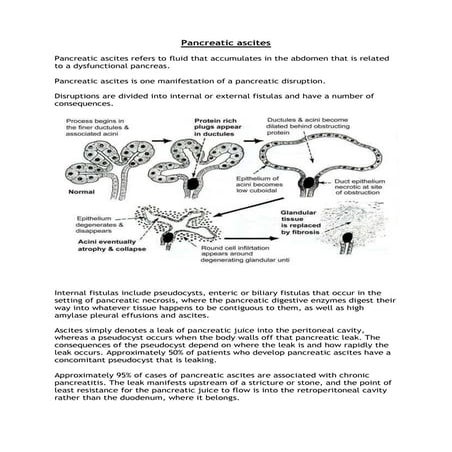 Pancreatic ascites