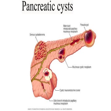 Pancreatic cyst and tumour