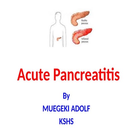 Acute pancreatis , inlamation of the pancrease | PPTX