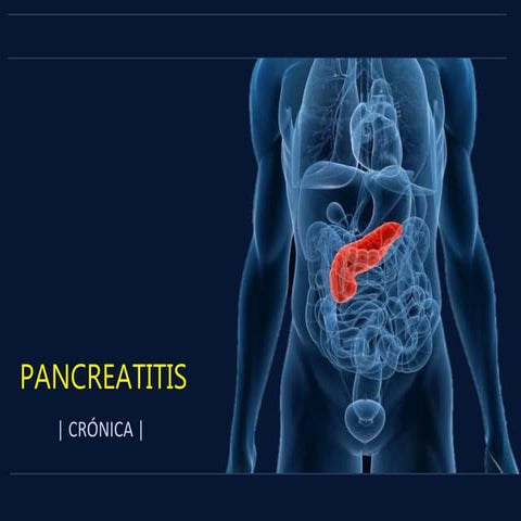 Pancreatitis Cronica