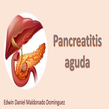 Pancreatitis Aguda