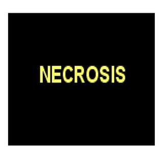 Pancreatitis clase i part 2.ppt