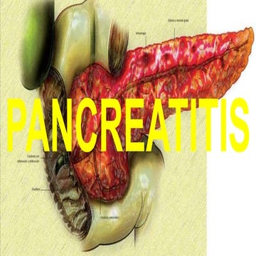 PANCREATITIS PRESENTACION