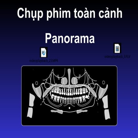 Panorama | PPT