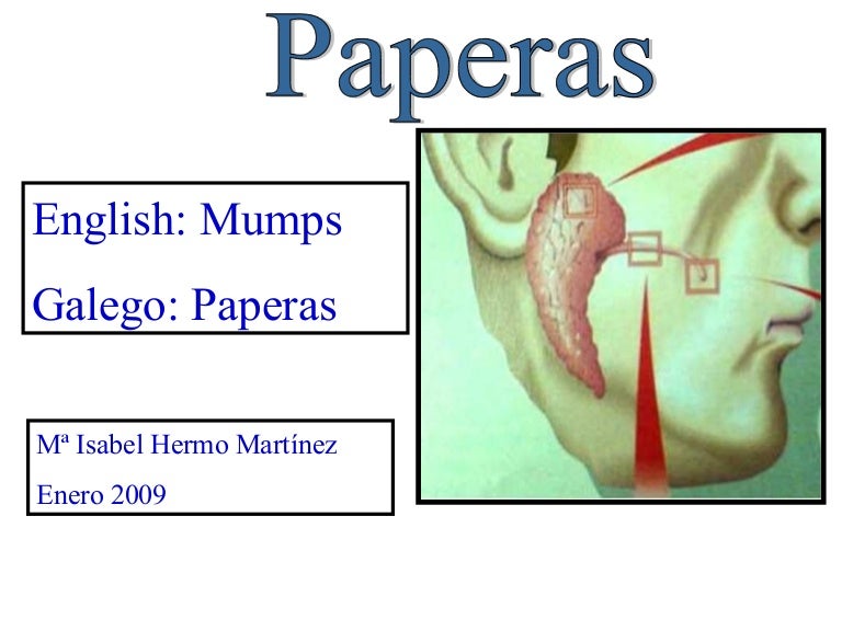Paperas, M.H.