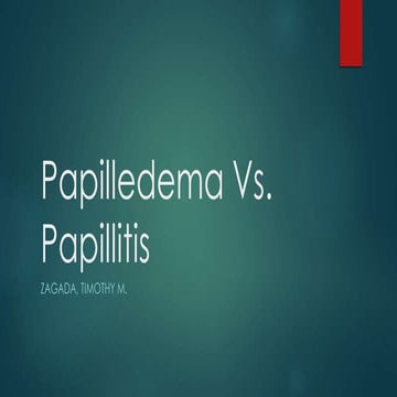 Papilledema vs papillitis with notes  timothy zagada