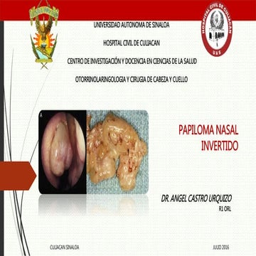 Papiloma nasal invertido