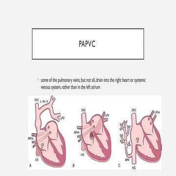 PNEUMONIAS IMAGING RADIOLOGY PPTX 1.pptx
