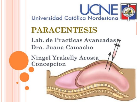 Thoracentesis | PPT
