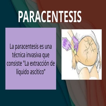 PARACENTESIS , PROCEDIMIENTO QUIRÚRGICO INVASIVO | PPTX