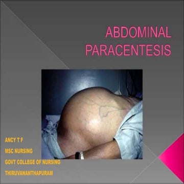 Paracentesis