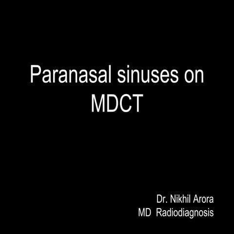 Paranasal sinuses .pptx