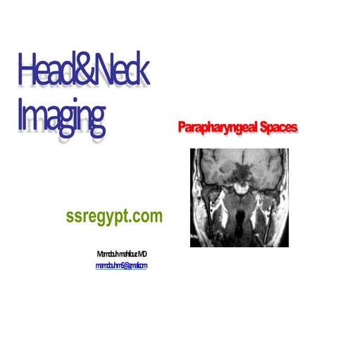 ALL ABOUT DETALED DESCRIPTION Parapharyngeal-spaces.pptx