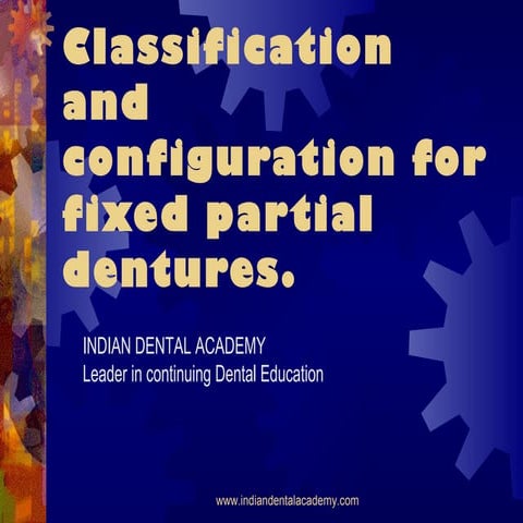 classification and configuration for fixed partial dentures/dental courses