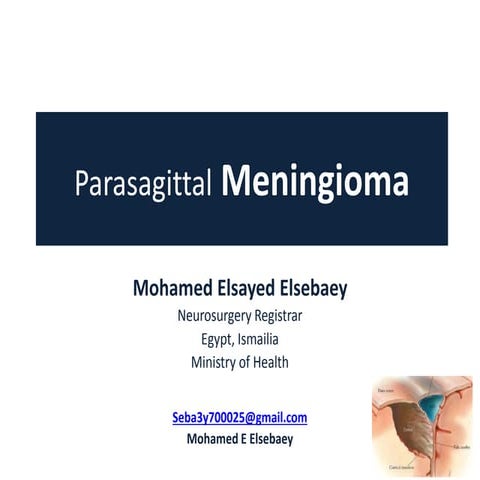 Parasagittal meningioma 