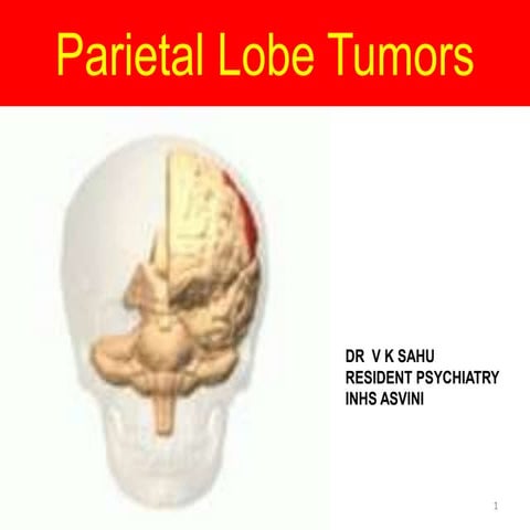 Parietal lobe tumor