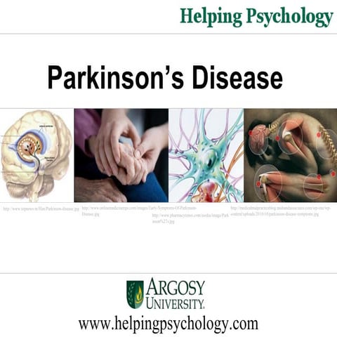 Parkinson’s Disease