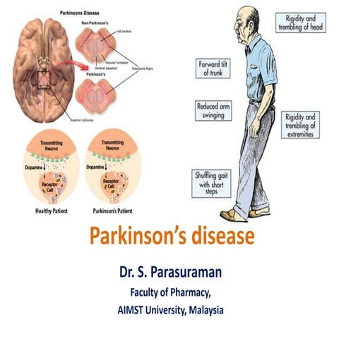 Parkinson’s disease