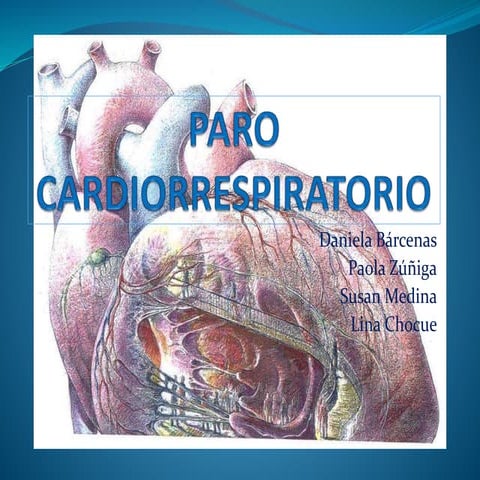 Paro cardiorespiratorio