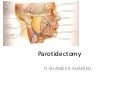 Parotidectomy