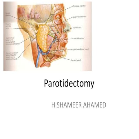 Parotidectomy