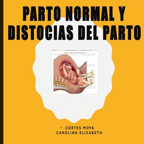Presentación sobre Trabajo de parto .pptx