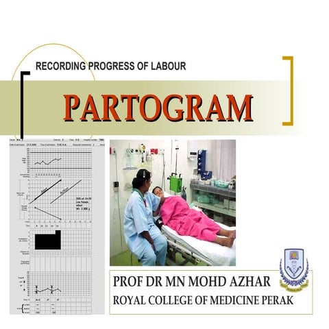 Partogram