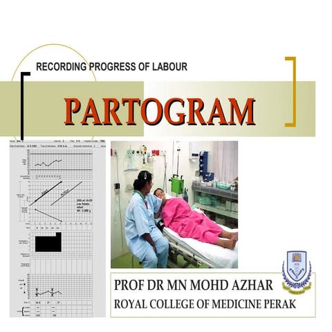 Partogram