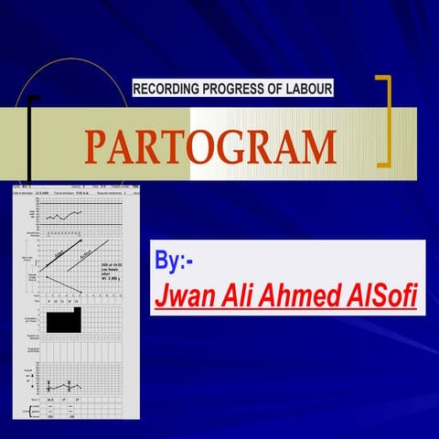 partogram-230420134156-56014911 1010.pptx