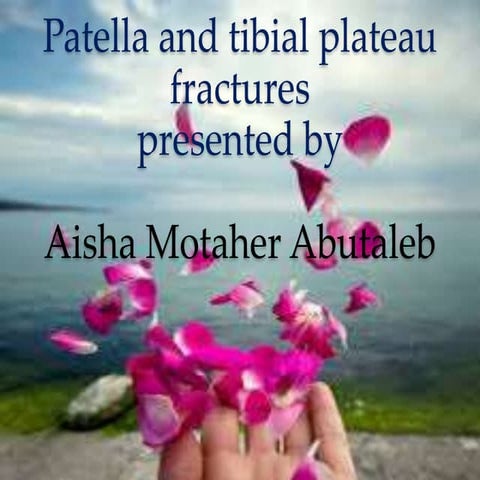 Patella and tibial plateau fractures  